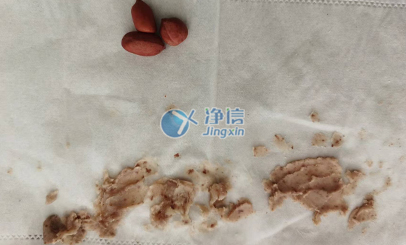 多樣品研磨儀對(duì)花生樣品的研磨效果